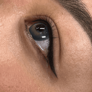 Sign up for Eyelid Surgery